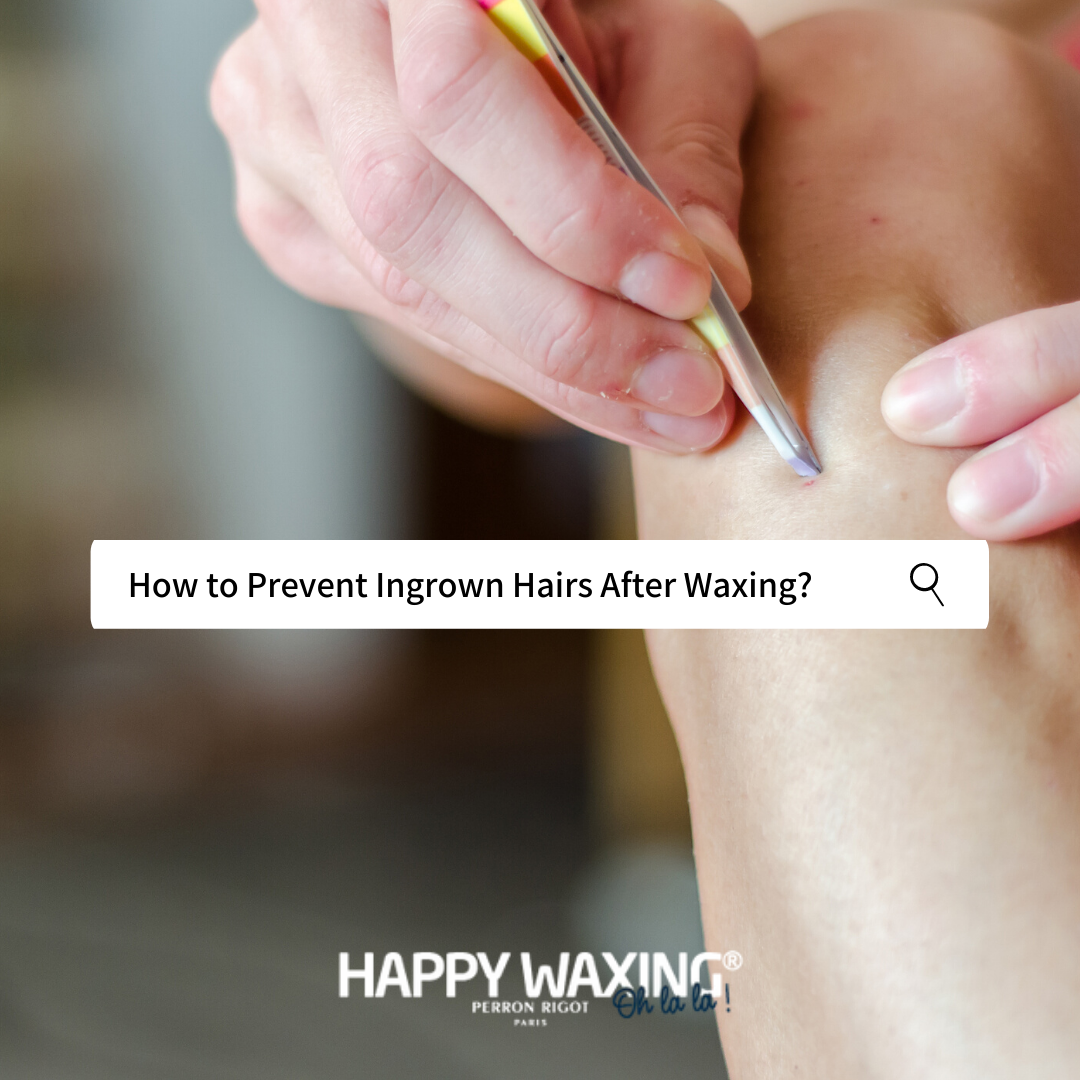 How to Prevent Ingrown Hairs After Waxing?
