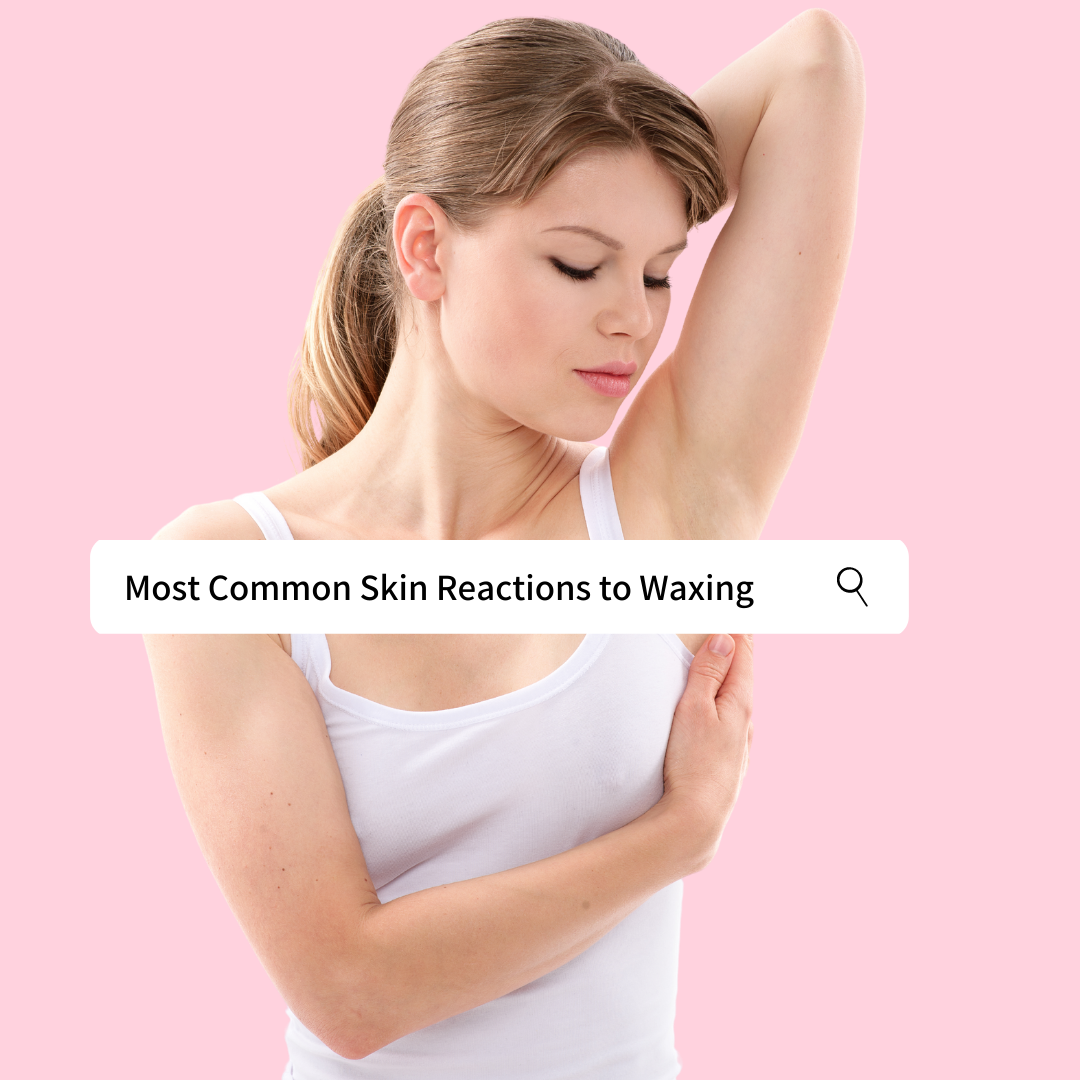 most common skin reactions to waxing